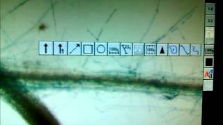 GUS Assay and root microscopy [upl. by Amethyst236]