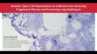 10102024  Alveolar Type 2 Cell Rejuvenation as a Window into Reversing Progressive Fibrosis [upl. by Savory754]