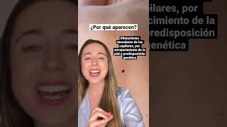 Cómo eliminar LUNARES ROJOS ❤️ dermatologia skincare pielperfecta lunares shorts [upl. by Gula]