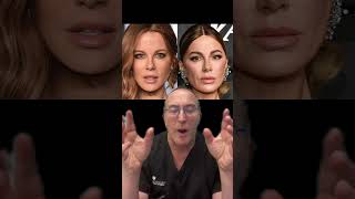 Kate Beckinsale facial analysis by plastic surgeon [upl. by Sedrul]