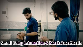 General Anesthesia Intubation Procedure  Small Baby Intubation amp Anesthesia Mask Anesthetic Waseem [upl. by Legnalos102]