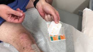 OPSITES Application of waterproof bandages [upl. by Arsuy]