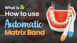 What is amp How to use Automatic Matrix Band  SuperEndo [upl. by Falconer27]