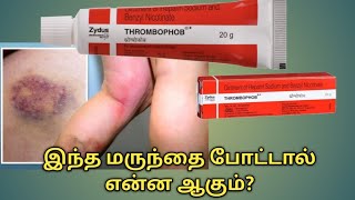 Thrombophob ointment uses in tamilThrombophob ointment benefits in tamilThrombophob ointment uses [upl. by Laurene]