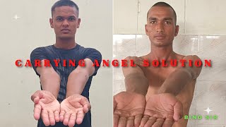 CARRYING ANGLE best exercise  carry angle  carrying angle  carrying angle kaise thik kare  hand [upl. by Nalced]