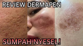 DERMAPEN REVIEW HARI KE HARI  GA NYANGKA JADI GINI [upl. by Carilla]