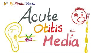 Acute Otitis Media AOM  5minutereview  ENT playlist [upl. by Ahsilahs]