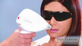 Lumenis LightSheer Desire Laser Hair Removal [upl. by Dlorag808]