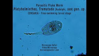 Parasitic fluke worm  Trematode cercaria larva [upl. by Hayn768]