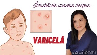 VARICELA la COPII Vărsat de vânt simptome tratament izolare [upl. by Acile792]