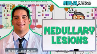 Medullary Lesions Medial and Lateral Medullary Syndromes [upl. by Eilyab]