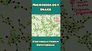 Corynaebacterium diphtheriae image  Microbiology Medicine  shorts [upl. by Kreegar740]