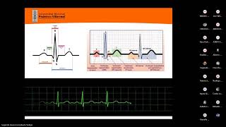 fisiopatología  CARDIOLOGÍA II arritmias cardiacas [upl. by Athiste]