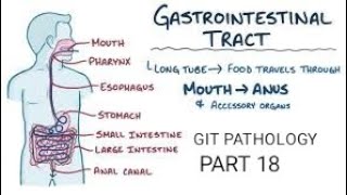 stomach  gastric adenocarcinoma pathology git stomach [upl. by Evonne]