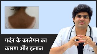 Reasons and Cure For Dark Neck  जानिए कारण और इलाज For Dark Neck  Clear Skin Pune [upl. by Bhatt]