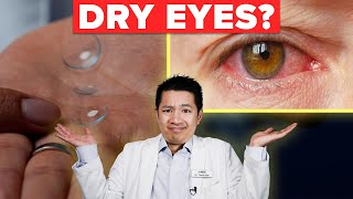 How Scleral Lenses Can Help Your Dry Eyes [upl. by Libyc609]