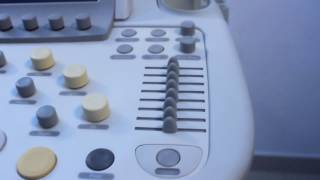 Philips IU22 Over View  ULTRASOUNDINDIA [upl. by Biebel]