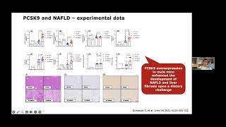 Theocharidou E The Role of PCSK9 in the Pathogenesis of Nonalcoholic Fatty Liver Disease [upl. by Pigeon]