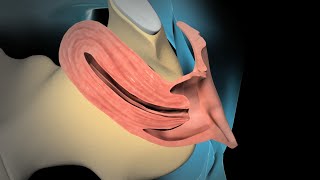 Dilation and Curettage D amp C [upl. by Hennahane189]