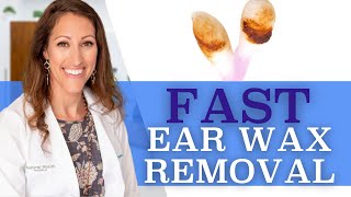 Clogged Ears  How to Remove Ear Wax At Home With Hydrogen Peroxide [upl. by Guimar]