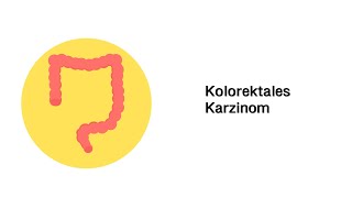 Darmkrebs Kolorektales Karzinom  Erkrankungen des Verdauungssystems [upl. by Malkin]