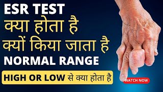 ESR test kya hota hai  esr badhne se kya hota hai  esr test hindi [upl. by Isacco42]