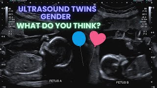 Ultrasound Pregnancy Twins Gender Identification Special interaction between the twins ❤️ [upl. by Eiveneg]