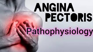 PATHOPHYSIOLOGY OF ANGINA PECTORIS [upl. by Ahsaercal]