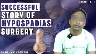 Best Hypospadias Surgeon in Kolkata  मूत्र का छिद्र सही जगह पर न खुलने की समस्या  Dr Nagwani [upl. by Berny]