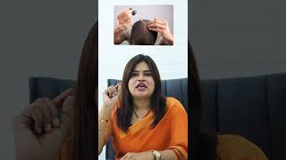 Minoxidil Life Long Use பண்ணனுமா  DrRadha Dermatology [upl. by Nav]