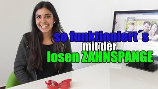 so funktioniert´s mit der losen ZAHNSPANGE  Orthodentix [upl. by Ecilahs355]