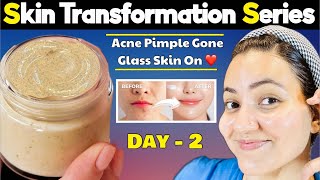 Glass Skin Transformation Series Day 2  Get Clear Healthy Glowing Spotless Glass Skin in 5 Days💕 [upl. by Ramraj]