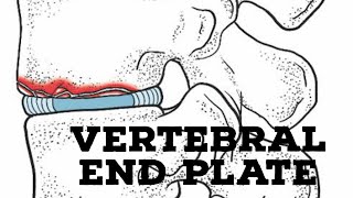 Vertebral end plate [upl. by Juxon]