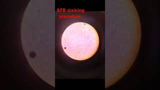 love cmlt microbiology AFB slide preparation and staining produre With proper description [upl. by Eicyal]