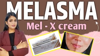 mel X cream uses  melasma homeopathic medicine  melasma homeopathic treatment [upl. by Chaddie493]