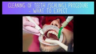 Cleaning of Teeth Scaling Procedure  What To Expect [upl. by Victorine46]