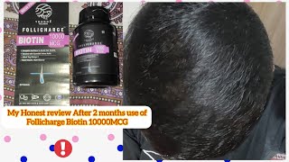 follicharge Biotin 10000mcg Review After use of 2 month Result [upl. by Keriann]