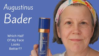 Using Augustinus Bader On Half My Face For 12 Months  Did It Help [upl. by Yrellam]