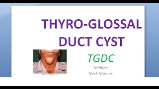 ENT ThyroGlossal Duct Cyst TGDC Neck swelling bump lump swollen midline middle center Sistrunk [upl. by Sill949]