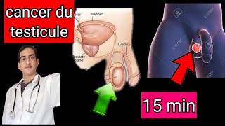 cancer du testicule [upl. by Doll]