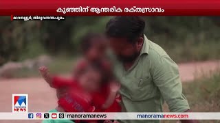 കുഞ്ഞുവീണത് മറച്ചുവച്ച് അംഗണവാടി അധികൃതര്‍ കുഞ്ഞിന് ആന്തരിക രക്തസ്രാവം Thiruvananthapuram [upl. by Anhcar510]