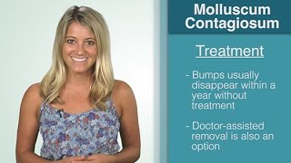 What Is  Molluscum Contagiosum [upl. by Aileve]