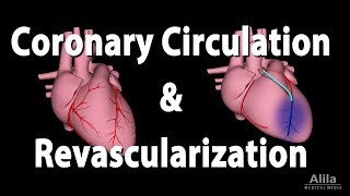 Coronary Circulation and Revascularization Animation [upl. by Lura]