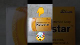 Ketostar Soap Uses amp Benefits  Best Soap for Dandruff amp Skin Care  Ketostar Soap Review [upl. by Ialokin977]