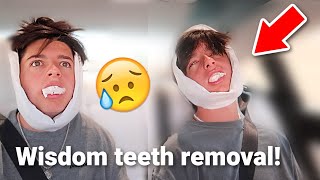 Identical TWINS Get Their WISDOM TEETH Out Hilarious Reaction [upl. by Milde]