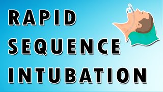 Rapid sequence intubation  Mnemonics [upl. by Haet]