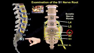 Examination Of S1 Nerve Root  Everything You Need To Know  Dr Nabil Ebraheim [upl. by Aicilec689]