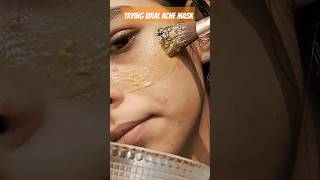 Diy acne face mask 🎀🎈  new  trending popular explore trending  latest [upl. by Isis]