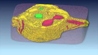 3D Reconstruction of Liver Portal Tracts From a Normal and Abnormal Dog [upl. by Kola714]