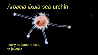 Arbacia lixula sea urchin newly metamorphosed to juvenile [upl. by Norreht]